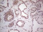 RARA Antibody in Immunohistochemistry (Paraffin) (IHC (P))