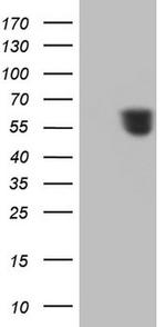RARA Antibody in Western Blot (WB)