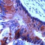 RARB Antibody in Immunohistochemistry (IHC)