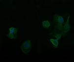 RARRES1 Antibody in Immunocytochemistry (ICC/IF)