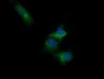 RARRES1 Antibody in Immunocytochemistry (ICC/IF)