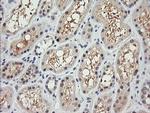 RARRES1 Antibody in Immunohistochemistry (Paraffin) (IHC (P))