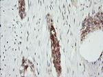RARRES1 Antibody in Immunohistochemistry (Paraffin) (IHC (P))
