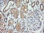 RARRES1 Antibody in Immunohistochemistry (Paraffin) (IHC (P))