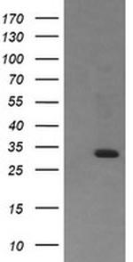 RARRES1 Antibody in Western Blot (WB)