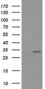 RARRES1 Antibody in Western Blot (WB)