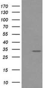 RARRES1 Antibody in Western Blot (WB)