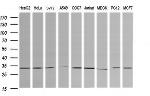 RARRES1 Antibody in Western Blot (WB)