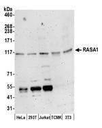 RASA1 Polyclonal Antibody