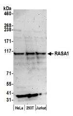 RASA1 Polyclonal Antibody