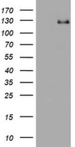 RASA1 Antibody in Western Blot (WB)