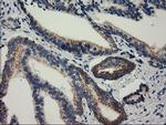 RASD2 Antibody in Immunohistochemistry (Paraffin) (IHC (P))