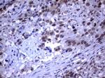 RASGRP3 Antibody in Immunohistochemistry (Paraffin) (IHC (P))