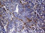 RASGRP3 Antibody in Immunohistochemistry (Paraffin) (IHC (P))