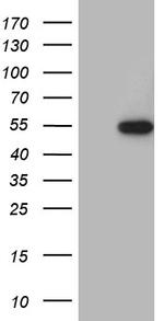 RAX Antibody in Western Blot (WB)