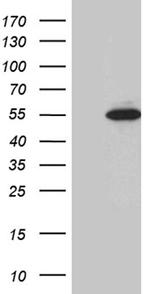 RAX Antibody in Western Blot (WB)