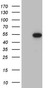 RAX Antibody in Western Blot (WB)