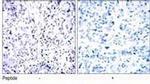 Rb Antibody in Immunohistochemistry (IHC)