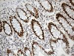 RB1 Antibody in Immunohistochemistry (Paraffin) (IHC (P))