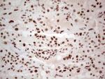RB1 Antibody in Immunohistochemistry (Paraffin) (IHC (P))