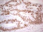 RB1 Antibody in Immunohistochemistry (Paraffin) (IHC (P))