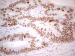 RB1 Antibody in Immunohistochemistry (Paraffin) (IHC (P))