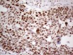 RB1 Antibody in Immunohistochemistry (Paraffin) (IHC (P))