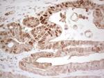 RB1 Antibody in Immunohistochemistry (Paraffin) (IHC (P))