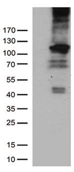 RB1 Antibody in Western Blot (WB)