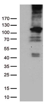 RB1 Antibody in Western Blot (WB)