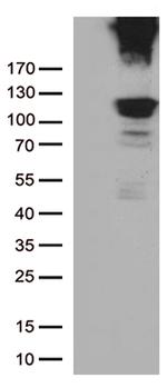 RB1 Antibody in Western Blot (WB)