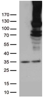 RB1 Antibody in Western Blot (WB)