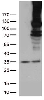 RB1 Antibody in Western Blot (WB)
