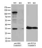 RB1 Antibody in Western Blot (WB)
