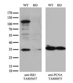 RB1 Antibody in Western Blot (WB)