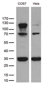 RB1 Antibody in Western Blot (WB)