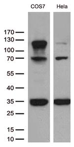 RB1 Antibody in Western Blot (WB)