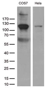 RB1 Antibody in Western Blot (WB)