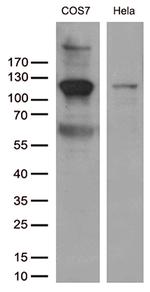 RB1 Antibody in Western Blot (WB)