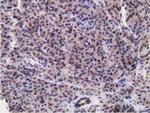 RBBP9 Antibody in Immunohistochemistry (Paraffin) (IHC (P))