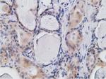 RBBP9 Antibody in Immunohistochemistry (Paraffin) (IHC (P))