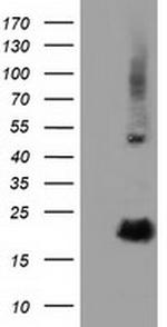 RBBP9 Antibody in Western Blot (WB)