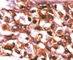 RBKS Antibody in Immunohistochemistry (IHC)