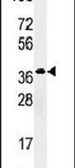 RBKS Antibody in Western Blot (WB)