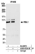 RBL1 Antibody in Immunoprecipitation (IP)