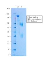 Negative Control for Rabbit Monoclonal Antibodies Antibody in Immunoelectrophoresis (IE)