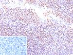 Epstein-Barr Virus (LMP-1) Recombinant Rabbit Monoclonal Antibody (EBV/9620R)