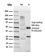 Bromodeoxyuridine (BrdU) Antibody in SDS-PAGE (SDS-PAGE)