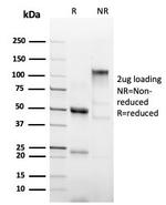 Hexa-histidine (Epitope Tag) Antibody in SDS-PAGE (SDS-PAGE)