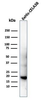 Hexa-histidine (Epitope Tag) Recombinant Rabbit Monoclonal Antibody (6HIS, 6402R)